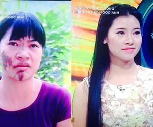Cô gái dân tộc Sán Dìu xinh đẹp sau 3 tháng dao kéo