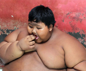 Choáng váng: Bé trai mới 10 tuổi đã nặng 192kg