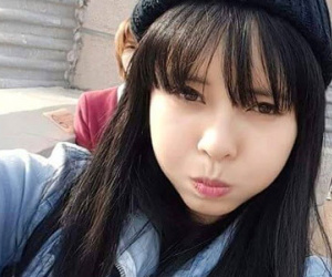 Cô gái sứt môi lột xác trở nên xinh đẹp nhờ dao kéo