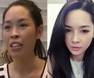 Cuộc đời sang trang của cô gái lột xác nhờ phẫu thuật thẩm mỹ
