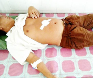 Bị đâm trọng thương khi ngăn côn đồ chém hàng xóm