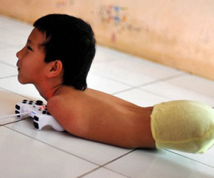 Câu chuyện cảm động về nghị lực sống của cậu bé 11 tuổi không chân không tay