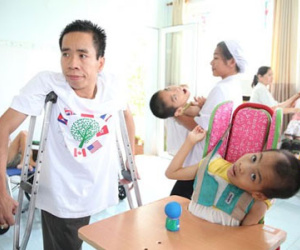 Ba lần tách cặp song sinh dính liền đáng nhớ của bác sĩ Việt