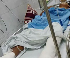 Đình chỉ bác sĩ BV Việt Đức mổ chân trái lộn sang chân phải