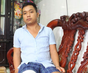 Bệnh nhân bị cưa chân ở Sài Gòn vì bác sĩ thiếu kinh nghiệm