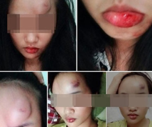 Con dâu bị bố chồng đạp vào mặt chỉ vì muốn bật điều hòa?