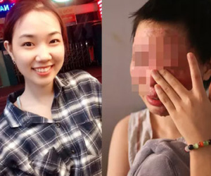 Nữ sinh từng bị tạt axit chấn động Sài Gòn: "Em vẫn không hiểu mình đã làm gì sai..."