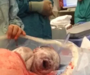 Clip: Bác sĩ khoanh tay đứng nhìn em bé tự chui ra khỏi bụng mẹ theo phương pháp sinh mổ tự nhiên