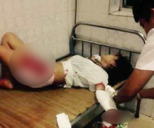 Thấy bạn thân chăm sóc bạn trai, cô gái ghen tuông rạch tay tự tử