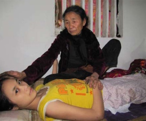 Thiếu nữ 8 năm chờ chết đã qua đời vì chảy máu tủy sống