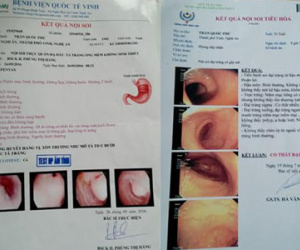 Thực hư GS đầu ngành mở bụng nhưng không cắt khối u