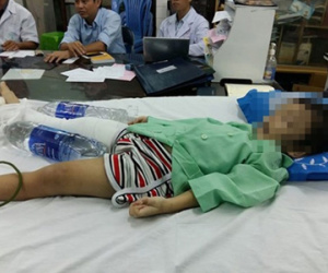 Cháu bé bị mẹ ruột và cha dượng "tung cước" gãy chân xuất viện