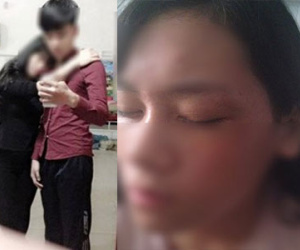 Nữ sinh Bắc Giang “tố” bị bạn trai chặn đánh sau chia tay