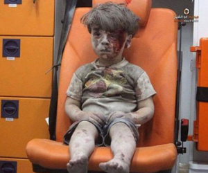 Cậu bé Syria bị thương làm dậy sóng mạng xã hội