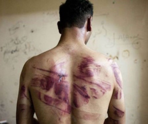 Lời kể kinh hoàng của những người bước ra từ nhà tù Syria