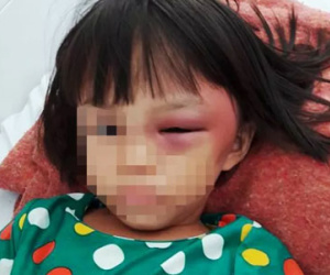 Nghi án bé gái 7 tuổi bị mẹ kế bạo hành