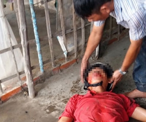 Ngã xe dưới mưa, người đàn ông nguy kịch