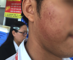 Bạn gái trễ giờ lên máy bay, nam thanh niên xông vào đánh nhân viên hàng không