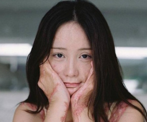 Người mẫu teen từng bị thiêu sống vì tình lộ diện sau 5 năm