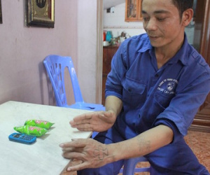 Phút cấp cứu phụ nữ thuê người chặt chân tay