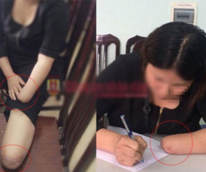 Thuê chặt chân tay để hưởng bảo hiểm 3 tỷ trong khi đang mang án tù do môi giới mại dâm
