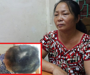 Trần tình của người phụ nữ cụt chân thuê giang hồ đánh ghen osin 19 tuổi cặp với chồng 62 tuổi