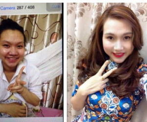 Bị nhà chồng chê xấu, mẹ một con đi phẫu thuật thẩm mỹ “lột xác” thành hot girl