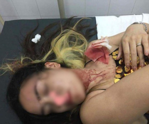 Hà Nội: Cô gái mang bầu 2 tháng tố bị nhân viên quán bar Q-Club đánh nhập viện