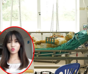 Nỗi đau tột cùng của cô gái bỏng xăng sau va chạm giao thông
