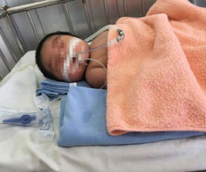 Bác sĩ trưởng khoa sản chậm ký giấy mổ, con sản phụ ra đời tím tái, suy hô hấp rồi tử vong?