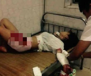 Thiếu nữ 19 tuổi cầm dao tự rạch bụng vì bị anh trai đánh vô cớ