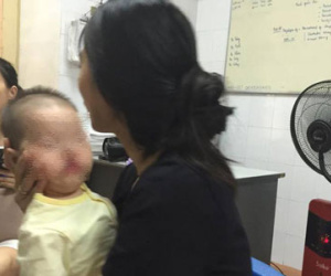 Lạ lùng bé 1 tuổi cứ cất tiếng khóc như tiếng mèo kêu