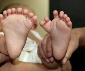 Kỳ lạ em bé có đến 31 ngón tay và chân