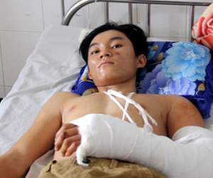 Nam thanh niên bị máy hút lúa “nuốt” cánh tay