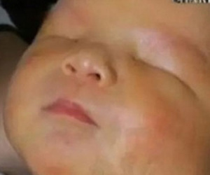 Mẹ đau đớn phát hiện con trai sinh ra không có mắt