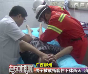 Nam thanh niên khốn khổ vì bị mắc kẹt chiếc nhẫn vào "của quý" suốt 2 ngày