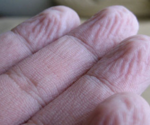 Tại sao nếp nhăn nhúm đáng sợ xuất hiện trên đầu ngón tay khi ngâm nước?