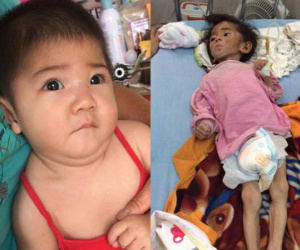 Hình ảnh mới của bé gái 14 tháng tuổi nặng 3,5kg sau hơn 3 tháng được mẹ nuôi chăm sóc