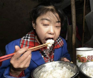 Kỳ lạ bé gái 15 tuổi mỗi ngày ăn 7kg gạo nhưng không mập lên nổi