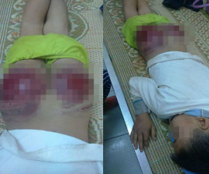 Bố đánh con tứa máu ở Thái Nguyên: "Tôi cũng thương lắm, nhưng..."