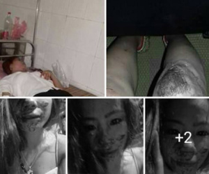 Gương mặt bê bết máu của người vợ trẻ đẹp tố chồng đánh dập mũi, dãy xương sườn