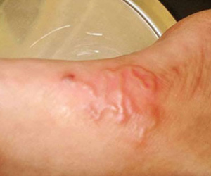 Con vật ghê sợ từ rau sống, ốc, tôm, cua... tàn phá khắp cơ thể người