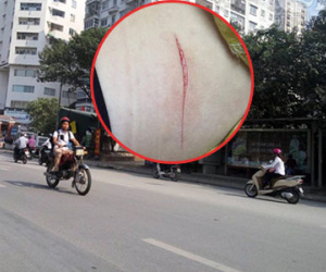Hà Nội: Cô gái trẻ bị 2 tên cướp táo tợn cướp túi xách và làm rách hông bằng vật sắc nhọn
