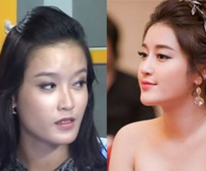 Loạt ảnh "dìm hàng" khiến Á hậu Huyền My bị nghi ngờ "dao kéo"