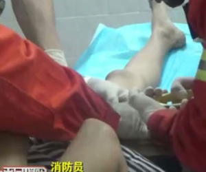 Phải cắt bỏ "của quý" vì trót dại cất tạm vào chai nước suốt 4 ngày