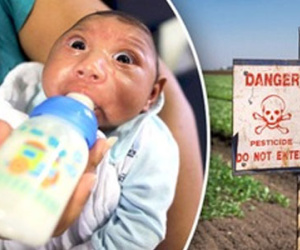 Bé 4 tháng tuổi bị dị tật đầu nhỏ nghi do nhiễm virus Zika: Bộ y tế họp khẩn