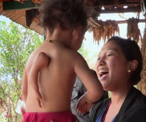Bé trai Nepal "mọc" thêm tay ở... lưng