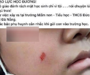 Đình chỉ 1 tháng, phạt 5 triệu cô giáo làm trầy má HS tại Đà Nẵng