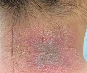 Kiến ba khoang tấn công nhà dân ở Hà Nội