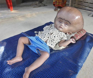 Cô bé "người ngoài hành tinh" được tìm thấy trong ngôi làng nghèo khó